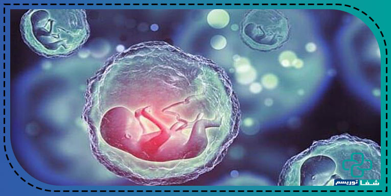 IVF 2
